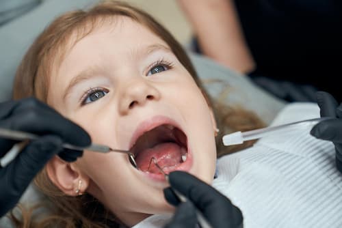 tratamiento dental en niños prevención de gingivitis