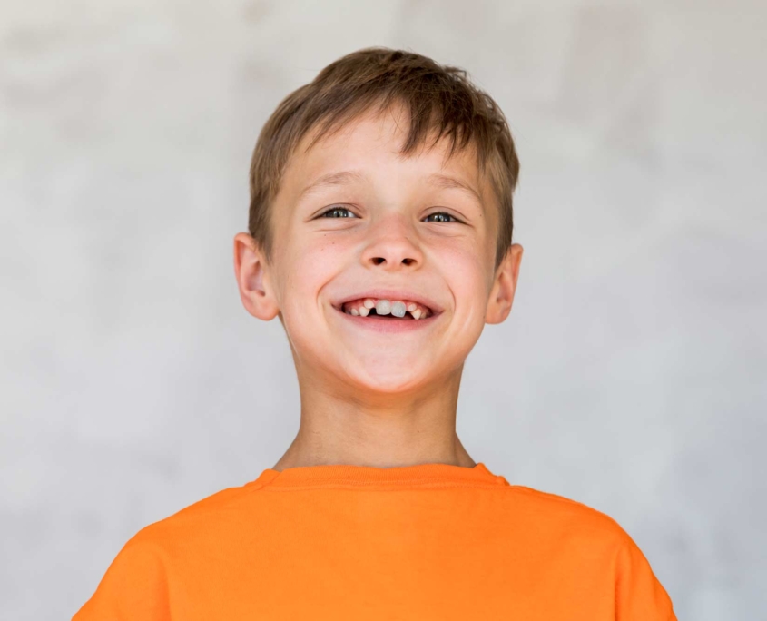 Niño sonriendo con dientes oscurecidos portada blog coi