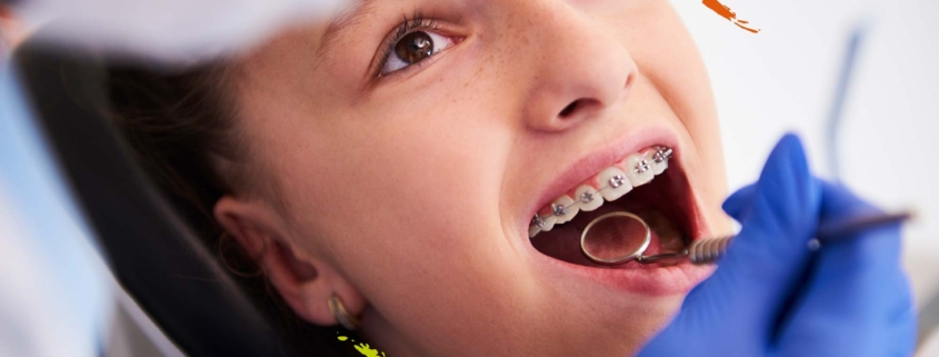 niña en la consulta del dentista con brackets infantiles